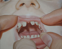 Teeth Peak